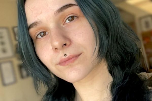 Chronic Condition Leaves Woman Seeking Relief After Years of Delay