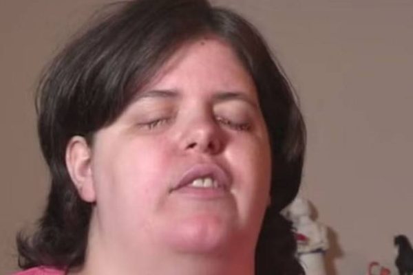 Woman Reveals Coercion in Case of Self-Inflicted Blindness