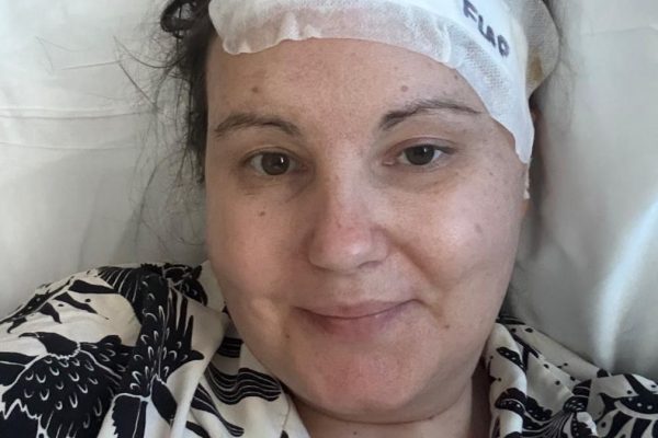 Woman’s Brain Tumor Misdiagnosed as Anxiety for Years
