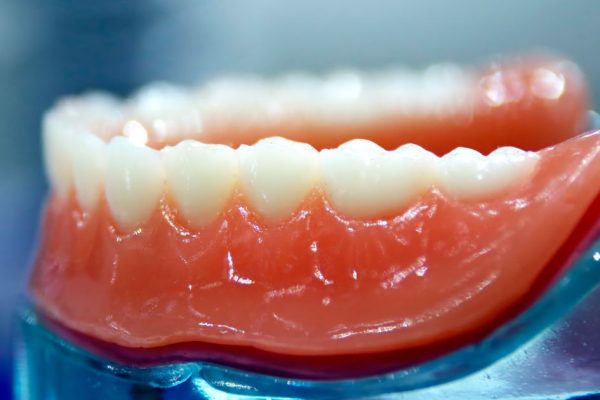 Dental Experts Issue Warning Over Rising Risks of ‘Turkey Teeth’ Trend