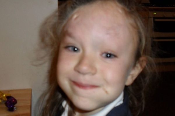 Overcoming Adversity: Woman Born With Rare Skin Condition Shares Her Story